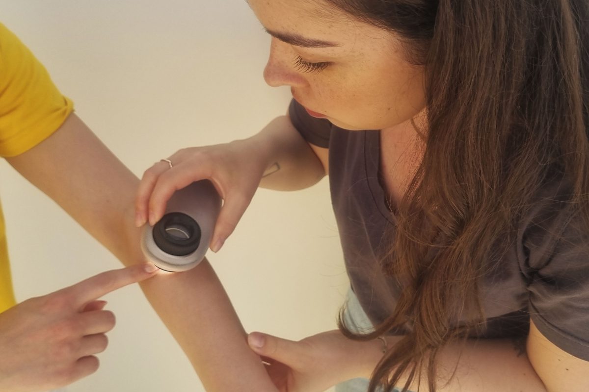 Besplatni dermatološki pregled u Slavonskom Brodu