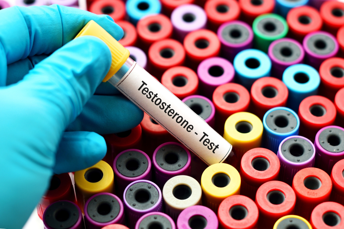 Testosteron test